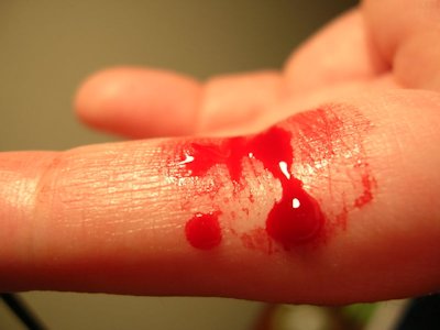 bleed