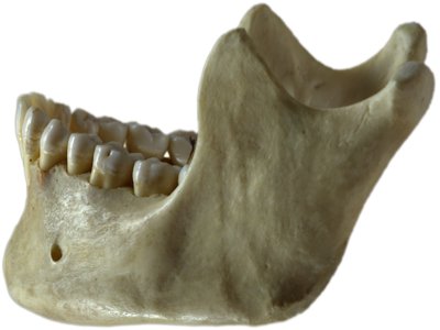 Jaw