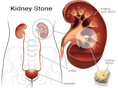 Kidney