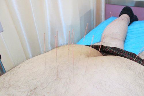 Paul with Needles in his Back and Leg - Scene 11