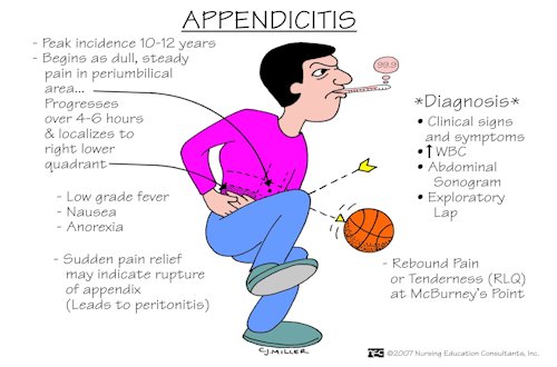 Early Appendicitis Symptoms - Page 6